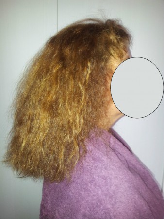 Antes aplicaciónAlisado Fotónico